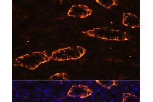 Immunofluorescence analysis of Rat kidney using AQP3 Polyclonal Antibody at dilution of 1:100. (AQP3 抗体)