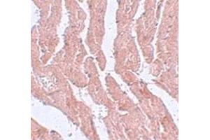 Immunohistochemical staining of mouse heart tissue with LZTR1 polyclonal antibody  at 5 ug/mL dilution. (LZTR1 抗体  (N-Term))