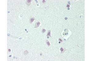 Human Brain, Cortex: Formalin-Fixed, Paraffin-Embedded (FFPE) (NOVA1 抗体  (C-Term))