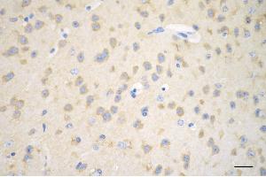 Immunohistochemistry was performed on paraffin-embedded mouse brain using huntingtin antibody (ABIN7799005), 1:200). (Recombinant Huntingtin 抗体)