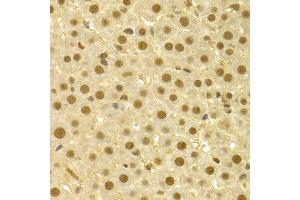 Immunohistochemistry of paraffin-embedded rat liver using CDC25A antibody (ABIN5970519) at dilution of 1/100 (40x lens). (CDC25A 抗体)