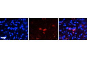 Rabbit Anti-CLN6 Antibody     Formalin Fixed Paraffin Embedded Tissue: Human Pineal Tissue  Observed Staining: Cytoplasmic in cell bodies of pinealocytes  Primary Antibody Concentration: 1:100  Other Working Concentrations: 1/600  Secondary Antibody: Donkey anti-Rabbit-Cy3  Secondary Antibody Concentration: 1:200  Magnification: 20X  Exposure Time: 0. (CLN6 抗体  (C-Term))
