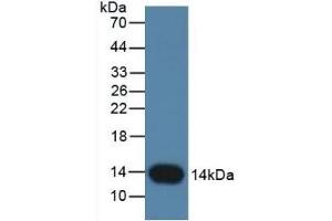Detection of CSTB in Rat Placenta Tissue using Monoclonal Antibody to Cystatin B (CSTB) (CSTB 抗体  (AA 2-98))