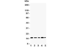 Western blot testing of TIA-1 antibody and Lane 1:  Jurkat;  2: Raji;  3: CEM;  4: HT1080;  5: K562 cell lysate. (TIA1 抗体  (N-Term))
