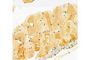 Immunohistochemistry (Paraffin-embedded Sections) (IHC (p)) image for anti-Potassium Voltage-Gated Channel, Subfamily H (Eag-Related), Member 5 (KCNH5) antibody (ABIN7075159)