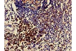 Immunohistochemistry of paraffin-embedded human spleen tissue using ABIN7171382 at dilution of 1:100 (CD3 epsilon 抗体  (AA 23-126))