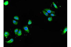 Immunofluorescent analysis of HepG2 cells using ABIN7154324 at dilution of 1:100 and Alexa Fluor 488-congugated AffiniPure Goat Anti-Rabbit IgG(H+L) (Golgin A3 抗体  (AA 217-405))