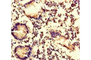 Immunohistochemistry of paraffin-embedded human appendix tissue using ABIN7174949 at dilution of 1:100 (MYO1G 抗体  (AA 209-389))
