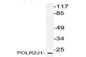 Western blot analysis of POLR2J1 in extracts from RAW264. (POLR2J 抗体)