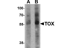 Western blot analysis of TOX in human colon tissue lysate with TOX antibody at (A) 1 and (B) 2 µg/mL. (TOX 抗体  (N-Term))