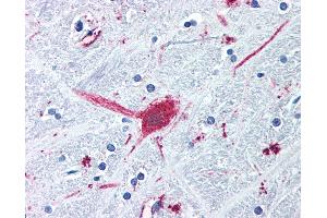 Anti-DRD3 / Dopamine Receptor D3 antibody IHC of human brain, globus pallidus. (DRD3 抗体  (Cytoplasmic Domain))