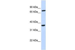 Western Blotting (WB) image for anti-Chemokine (C-C Motif) Receptor-Like 2 (CCRL2) antibody (ABIN2458062) (CCRL2 抗体)