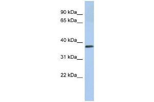Calreticulin 3 antibody used at 1 ug/ml to detect target protein. (Calreticulin 3 抗体  (N-Term))