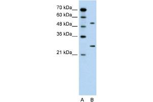 WB Suggested Anti-CACNB1 Antibody Titration:  0. (CACNB1 抗体  (Middle Region))