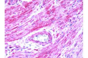 Human Prostate: Formalin-Fixed, Paraffin-Embedded (FFPE) (BDKRB2 抗体  (C-Term))