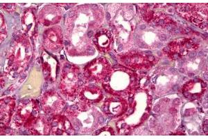 Anti-GHRHR antibody IHC staining of human kidney, tubules. (GHRHR 抗体  (AA 351-400))