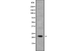 Western blot analysis NCALD using COS7 whole cell lysates (NCALD 抗体)
