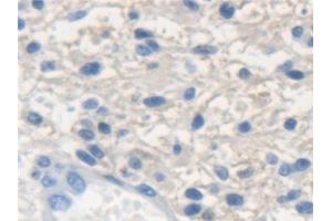 Immunohistochemistry (IHC) image for anti-Keratin 33A (KRT33A) (AA 57-363) antibody (ABIN7441730)