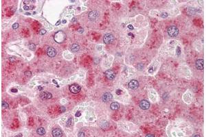 Human Liver: Formalin-Fixed, Paraffin-Embedded (FFPE) (Coagulation Factor IX 抗体)