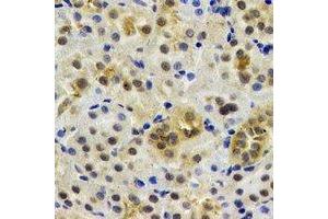 Immunohistochemical analysis of Rent2 staining in rat kidney formalin fixed paraffin embedded tissue section. (RENT2/UPF2 抗体)