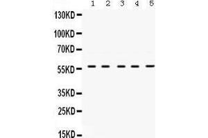 Western Blotting (WB) image for anti-Lymphocyte-Specific Protein tyrosine Kinase (LCK) (AA 468-506), (C-Term) antibody (ABIN3043870) (LCK 抗体  (C-Term))