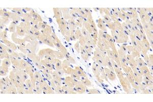 Immunohistochemistry (IHC) image for anti-Branched Chain Amino-Acid Transaminase 1, Cytosolic (BCAT1) (AA 174-386) antibody (ABIN7445060)