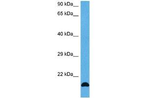 Host:  Mouse  Target Name:  FGF2  Sample Tissue:  Mouse Skeletal Muscle  Antibody Dilution:  1ug/ml (FGF2 抗体  (Middle Region))