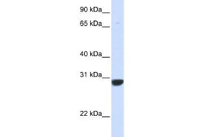 WB Suggested Anti-PNPO Antibody Titration: 0. (PNPO 抗体  (N-Term))