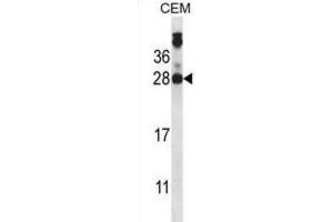 Western Blotting (WB) image for anti-Junctional Adhesion Molecule 2 (JAM2) antibody (ABIN2997813) (JAM2 抗体)