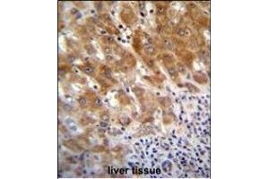 FAH Antibody (N-term) (ABIN655906 and ABIN2845306) immunohistochemistry analysis in formalin fixed and paraffin embedded human liver tissue followed by peroxidase conjugation of the secondary antibody and DAB staining. (FAH 抗体  (N-Term))