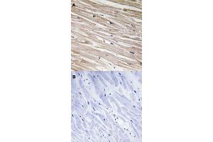 Immunohistochemical staining (Formalin-fixed paraffin-embedded sections) of human heart tissue with PEA15 (phospho S104) polyclonal antibody  without blocking peptide (A) or preincubated with blocking peptide (B) under 1:50-1:100 dilution. (PEA15 抗体  (pSer104))