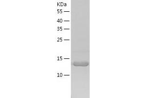 Western Blotting (WB) image for Peptidyl-tRNA Hydrolase 2 (PTRH2) (AA 64-179) protein (His tag) (ABIN7289525) (PTRH2 Protein (AA 64-179) (His tag))