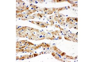Anti-SDHB antibody, IHC(P) IHC(P): Rat Cardiac Muscle Tissue (SDHB 抗体  (N-Term))