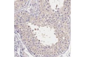 Immunohistochemical staining of human testis with KIAA1333 polyclonal antibody  shows weak cytoplasmic positivity in cells in seminiferus ducts at 1:200-1:500 dilution.