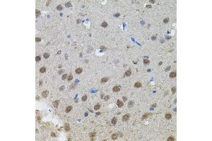 Immunohistochemistry (IHC) image for anti-N-Myc Proto-Oncogene Protein (MYCN) (AA 168-267) antibody (ABIN1680957)