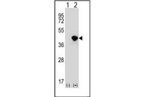 Western blot analysis of DFFA (arrow) using DFFA / ICAD Antibody (C-term) Cat. (DFFA 抗体  (C-Term))