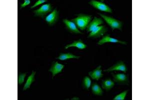 Immunofluorescence staining of Hela cells with ABIN7143995 at 1:66, counter-stained with DAPI. (AIMP1 抗体  (AA 25-180))