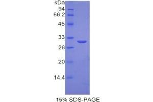 SDS-PAGE (SDS) image for Ornithine Decarboxylase 1 (ODC1) ELISA Kit (ABIN6574272)