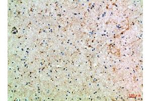 Immunohistochemical analysis of paraffin-embedded Human-brain, antibody was diluted at 1:100 (ASIC1 抗体  (AA 220-280))