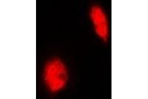 Immunofluorescent analysis of ERG staining in Hela cells. (ERG 抗体)