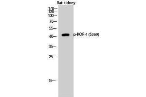 Western Blotting (WB) image for anti-Opioid Receptor, kappa 1 (OPRK1) (pSer369) antibody (ABIN3182199)