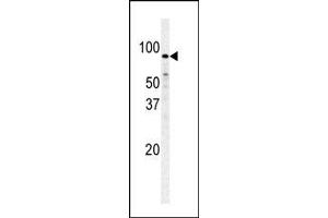 Image no. 1 for anti-phosphofructokinase, Muscle (PFKM) (C-Term) antibody (ABIN360633) (PFKM 抗体  (C-Term))