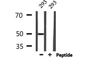 Western blot analysis of extracts from 293, using ADCK3 Antibody. (COQ8A 抗体)