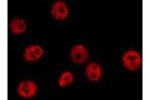 ABIN6278396 staining  Hela cells by IF/ICC. (RASSF2 抗体  (Internal Region))