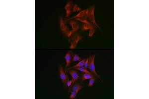 Immunofluorescence analysis of U2OS cells using STA Rabbit pAb (ABIN6128540, ABIN6148576, ABIN6148578 and ABIN6223670) at dilution of 1:50 (40x lens). (STAT5A 抗体  (AA 635-794))