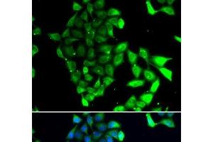 Immunofluorescence analysis of MCF-7 cells using MID1 Polyclonal Antibody (MID1 抗体)
