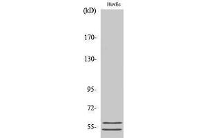 Western Blotting (WB) image for anti-serpin Peptidase Inhibitor, Clade A (Alpha-1 Antiproteinase, Antitrypsin), Member 6 (SERPINA6) (Internal Region) antibody (ABIN3183700) (SERPINA6 抗体  (Internal Region))