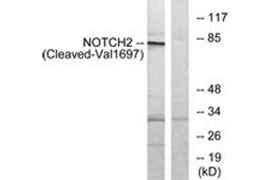 Western blot analysis of extracts from Jurkat cells, treated with etoposide 25uM 24h, using NOTCH2 (Cleaved-Val1697) Antibody. (NOTCH2 抗体  (Cleaved-Val1697))