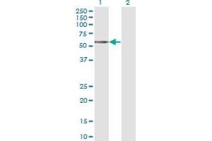 Western Blot analysis of TCN1 expression in transfected 293T cell line by TCN1 monoclonal antibody (M12), clone 3F10.
