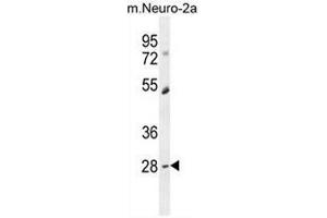 Western Blotting (WB) image for anti-Deleted in Primary Ciliary Dyskinesia Homolog (DPCD) (AA 99-140), (Middle Region) antibody (ABIN951973)